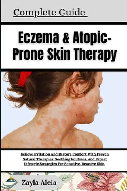 Complete Guide To Eczema & Atopic-Prone Skin Therapy: Relieve Irritation And Restore Comfort With Proven Natural Therapies, Soothing Routines, And Exp by Zayla Aleia