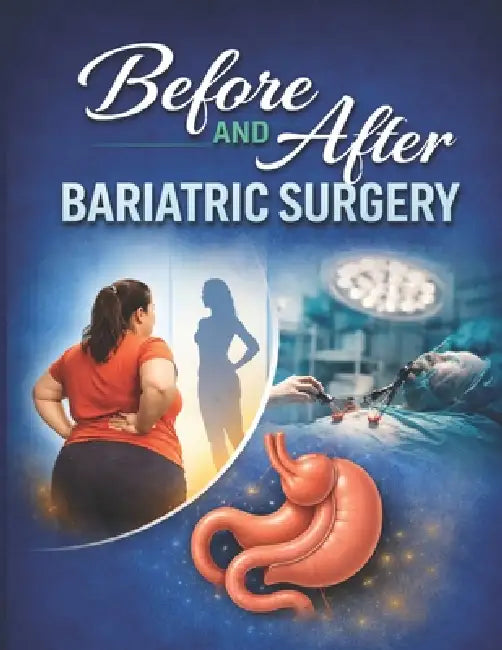 Before and After Bariatric Surgery by Liam Sanders
