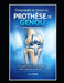 Comprendre et réussir sa prothèse de genou. by Elias Imam Imam Ei