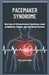 Pacemaker Syndrome: How Loss of Atrioventricular Synchrony Leads to Dizziness, Fatigue, and Low Blood Pressure by Theo Hawthorne