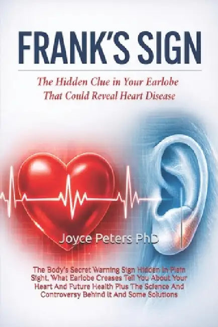 Frank's Sign: The Body's Secret Warning Sign Hidden In Plain Sight, What Earlobe Creases Tell You About Your Heart And Future Health Plus The Science by Joyce Peters