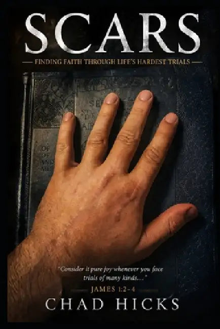 Scars: Finding Faith Through Life's Hardest Trials by Chad Hicks