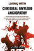 Living With Cerebral Amyloid Angiopathy: Prevent Stroke and Boost Brain Health with Proven Strategies, Expert Insights, and Practical Lifestyle Soluti by Amora Valeria