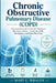 Chronic obstructive pulmonary disease (COPD): Your Essential Guide to Chronic Obstructive Pulmonary Disease - Symptoms, Daily Management, and Better B by Mary L. Whalen