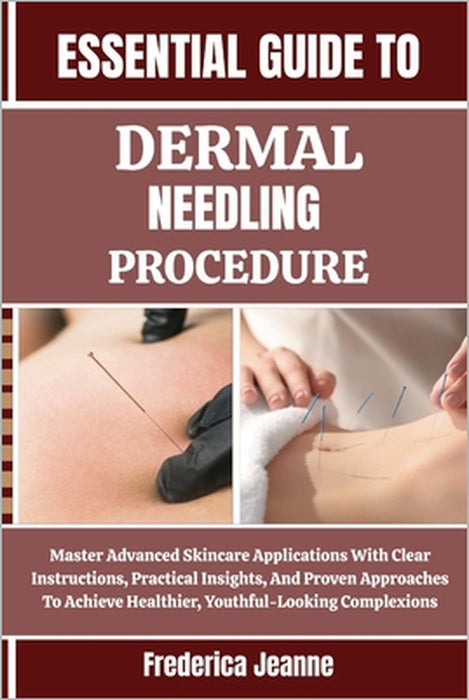 Essential Guide to Dermal Needling Procedure: Master Advanced Skincare Applications With Clear Instructions, Practical Insights, And Proven Approaches by Frederica Jeanne