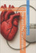 Me and My Pacemaker: Living with a Pacemaker by Hueston, Frederick M.
