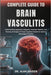 Complete Guide to Brain Vasculitis: Understanding Symptoms, Diagnosis, Treatment Options, And Recovery Strategies To Protect Cognitive Health For Opti by Alan Kaiden