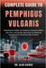 Complete Guide to Pemphigus Vulgaris: Comprehensive Insights Into Diagnosis, Treatment Options, Care Plans, And Lifestyle Approaches For Effectively M by Alan Kaiden