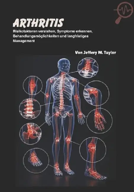 Arthritis: Risikofaktoren verstehen, Symptome erkennen, Behandlungsmöglichkeiten und langfristiges Management by Jeffery M. Taylor
