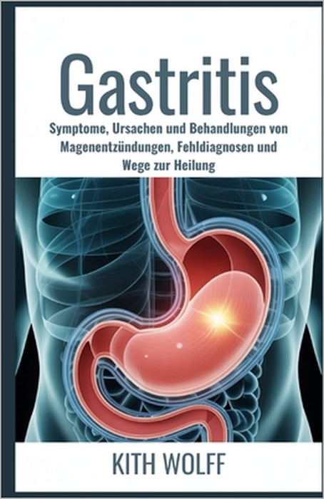 Gastritis: Symptome, Ursachen und Behandlungen von Magenentzündungen, Fehldiagnosen und Wege zur Heilung by Kith Wolff