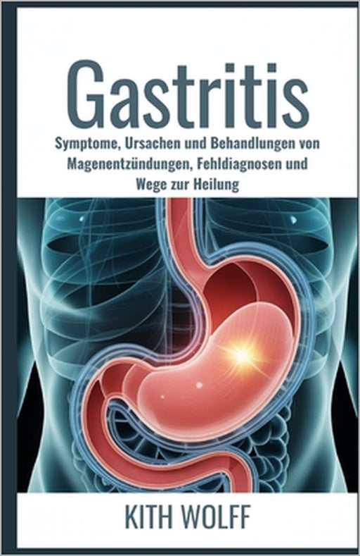 Gastritis: Symptome, Ursachen und Behandlungen von Magenentzündungen, Fehldiagnosen und Wege zur Heilung by Kith Wolff