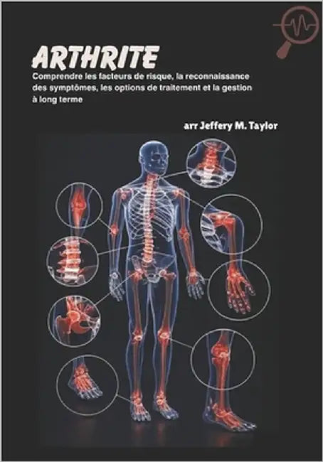 Arthrite: Comprendre les facteurs de risque, la reconnaissance des symptômes, les options de traitement et la gestion à long terme by M. Taylor, Jeffery