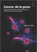 Cancer de la peau: Comprendre les risques, la détection précoce, le traitement et la gestion à long terme. by Julius J. Vieira
