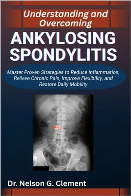 Understanding and Overcoming Ankylosing Spondylitis: Master Proven Strategies to Reduce Inflammation, Relieve Chronic Pain, Improve Flexibility, and R by G. Clement, Nelson