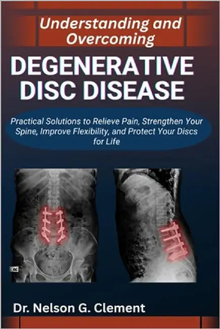 Understanding and Overcoming Degenerative Disc Disease: Practical Solutions to Relieve Pain, Strengthen Your Spine, Improve Flexibility, and Protect Y by G. Clement, Nelson