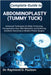 Complete Guide to Abdominoplasty (Tummy Tuck): Advanced Techniques for Body Contouring, Postoperative Care, Risk Reduction, and Achieving Aesthetic Ou by D. Paulson, Raymond