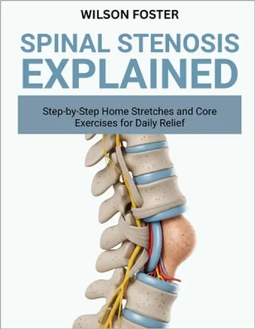 Spinal Stenosis Explained: Symptoms, Movement Tips, and Comfort Plans for Better Walking and Sleep by Foster, Wilson