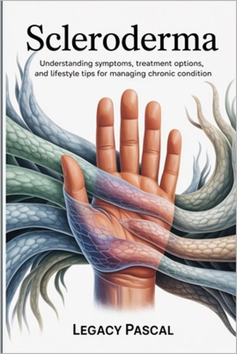 Overcoming Scleroderma: Understanding Symptoms, Treatment Options, and Lifestyle Tips for Managing Chronic Condition by Legacy Pascal