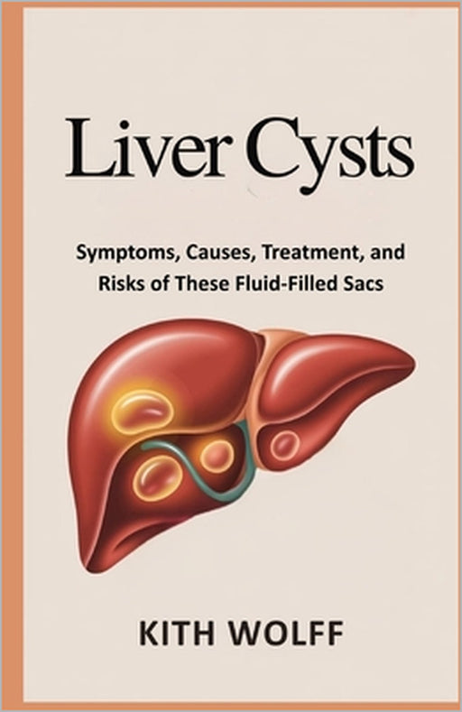 Liver Cysts: Symptoms, Causes, Treatment, and Risks of These Fluid-Filled Sacs by Kith Wolff