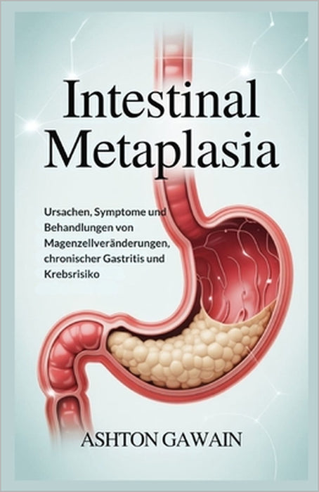 Intestinal Metaplasia: Ursachen, Symptome und Behandlungen von Magenzellveränderungen, chronischer Gastritis und Krebsrisiko by Ashton Gawain