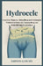 Hydrocele: Ursachen, Diagnose, Behandlung und verborgene Wahrheiten hinter der Ansammlung von Hodenflüssigkeit verstehen by Ashton Gawain