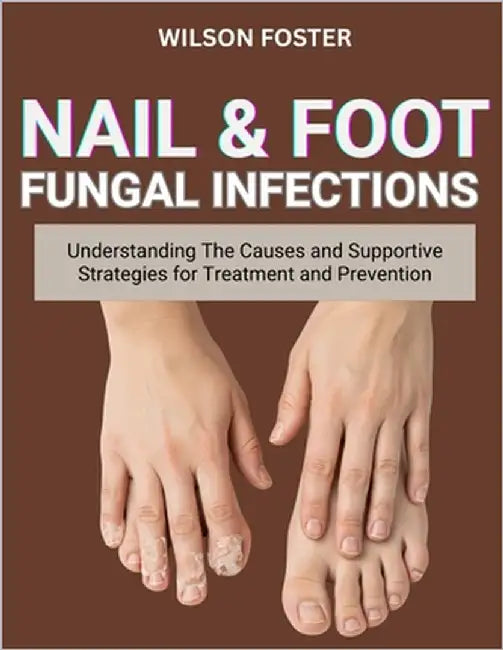 Nail & Foot Fungal Infections: Understanding The Causes And Supportive Strategies For Treatment And Prevention by Foster, Wilson