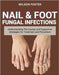 Nail & Foot Fungal Infections: Understanding The Causes And Supportive Strategies For Treatment And Prevention by Foster, Wilson