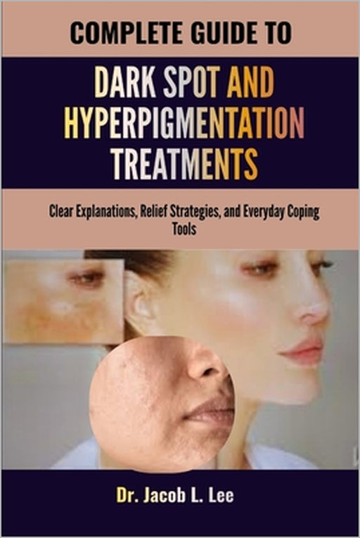 Complete Guide to Dark Spot and Hyperpigmentation Treatments: Clear Explanations, Relief Strategies, and Everyday Coping Tools by Jacob L. Lee