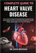 Complete Guide to Heart Valve Disease: Restore Cardiac Strength And Circulatory Balance Naturally Through Proven Lifestyle, Nutritional, And Preventiv by Jayce Beckham