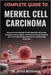 Complete Guide to Merkel Cell Carcinoma: Discover Proven Strategies To Halt Rapid Skin Cell Growth, Strengthen Immune Defense, And Recovery Through In by Jayce Beckham