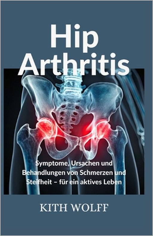 Hip Arthritis: Symptome, Ursachen und Behandlungen von Schmerzen und Steifheit - für ein aktives Leben by Kith Wolff