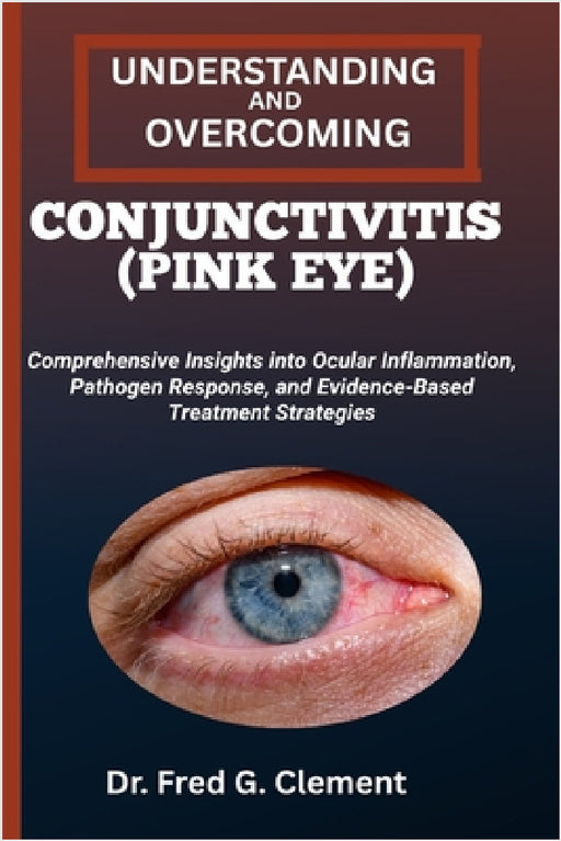 Understanding and Overcoming Conjunctivitis (Pink Eye): Comprehensive Insights into Ocular Inflammation, Pathogen Response, and Evidence-Based Treatme by Fred G. Clement