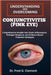 Understanding and Overcoming Conjunctivitis (Pink Eye): Comprehensive Insights into Ocular Inflammation, Pathogen Response, and Evidence-Based Treatme by Fred G. Clement