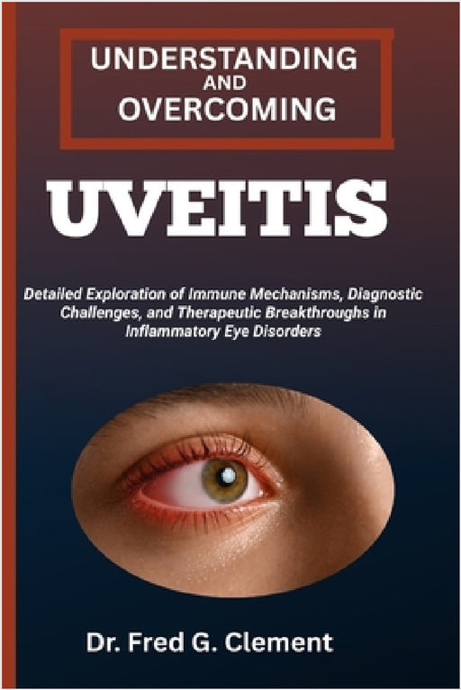 Understanding and Overcoming Uveitis: Detailed Exploration of Immune Mechanisms, Diagnostic Challenges, and Therapeutic Breakthroughs in Inflammatory by Fred G. Clement