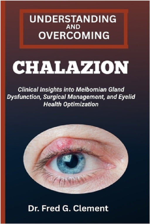 Understanding and Overcoming Chalazion: Clinical Insights into Meibomian Gland Dysfunction, Surgical Management, and Eyelid Health Optimization by Fred G. Clement