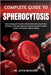 Complete Guide to Spherocytosis: Boost Energy and Strengthen Blood Health Naturally: Proven Strategies to Manage Symptoms, Improve Circulation, Reduce by Jayce Beckham