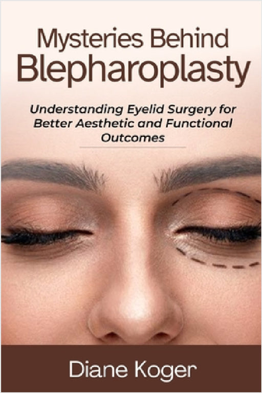 Mysteries Behind Blepharoplasty by Diane Koger