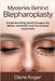 Mysteries Behind Blepharoplasty by Diane Koger
