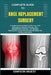 Complete Guide to Knee Replacement Surgery: A Comprehensive Insight To Recovery, Pain Management, Physical Therapy, Care, Rehabilitation Exercises, Jo by Simpson Wuest