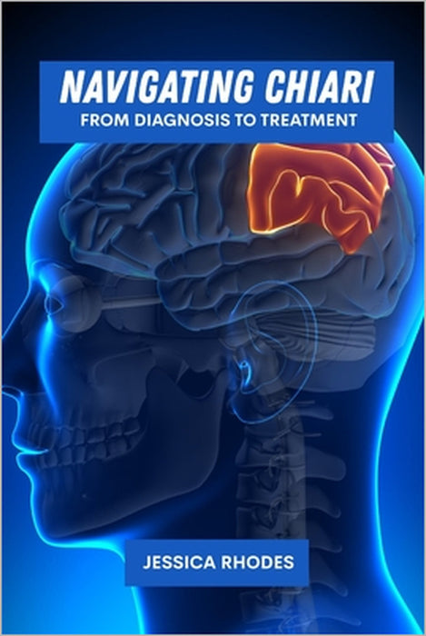 Navigating Chiari: From diagnosis to treatment by Jessica Rhodes