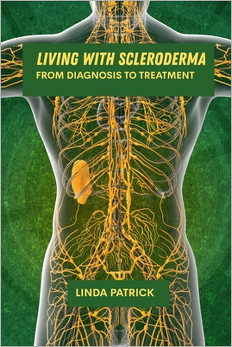Living with scleroderma: From diagnosis to treatment by Linda Patrick