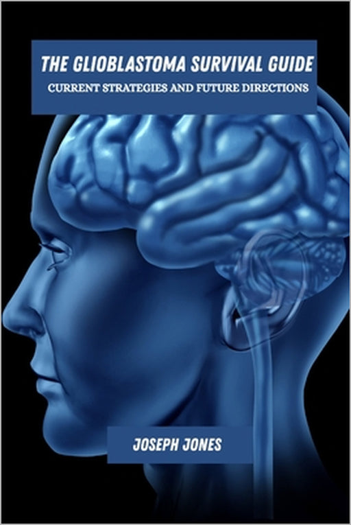 The glioblastoma survival guide: Current strategies and future directions by Joseph Jones