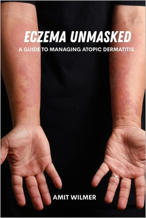 Eczema unmasked: A guide to managing atopic dermatitis by Amit Wilmer
