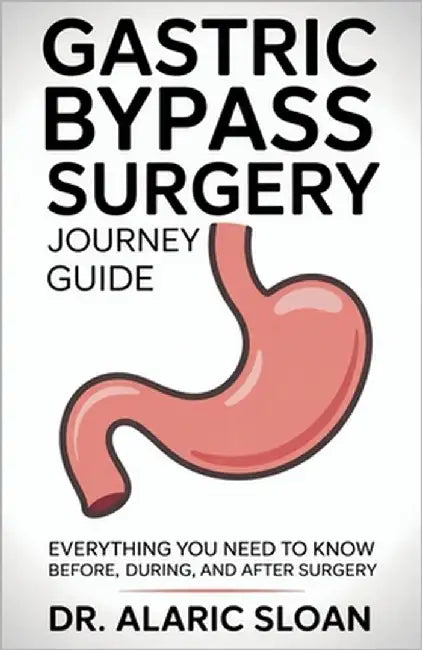 Gastric Bypass Surgery Journey Guide: Everything You Need to Know Before, During, and After Surgery by Sloan, Alaric