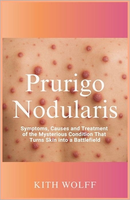 Prurigo Nodularis: Symptoms, Causes, and Treatment of the Mysterious Condition That Turns Skin into a Battlefield by Kith Wolff