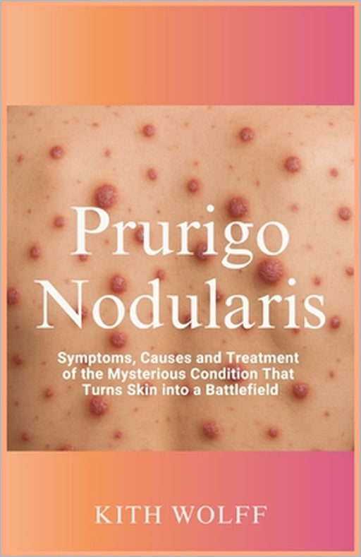 Prurigo Nodularis: Symptoms, Causes, and Treatment of the Mysterious Condition That Turns Skin into a Battlefield by Kith Wolff