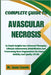 Complete Guide to Avascular Necrosis: In-Depth Insights Into Advanced Therapies, Lifestyle Adjustments, Rehabilitation And Overcoming Bone Degeneratio by Jaxon Lincoln
