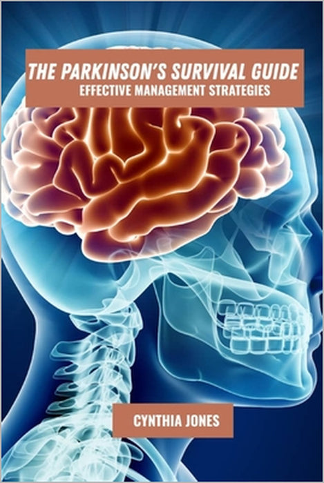 The parkinson's survival guide: Effective management strategies by Cynthia Jones