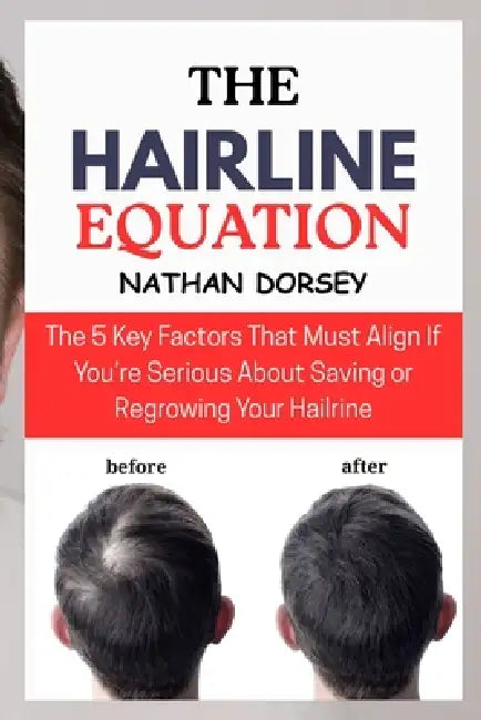 The Hairline Equation: The 5 Key Factors That Must Align if You're Serious About Saving or Regrowing Your Hair by Nathan Dorsey