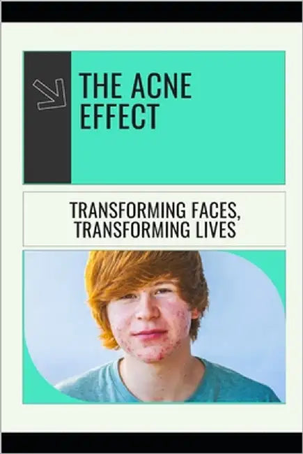The Acne Effect: Transforming Faces, Transforming Lives by Turner, Scarlett Y.